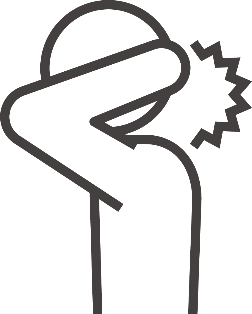 寝違い